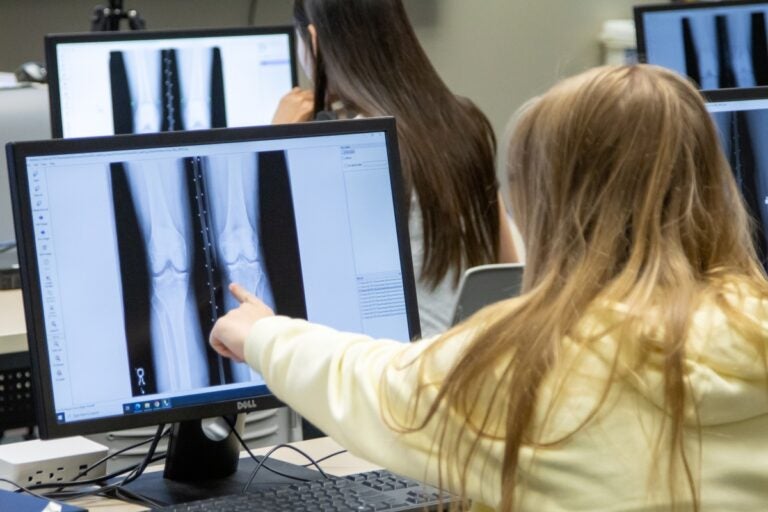 A young woman with long blonde hair and her back turned points at a computer monitor with her left hand pointing at radiograph images of a knee.