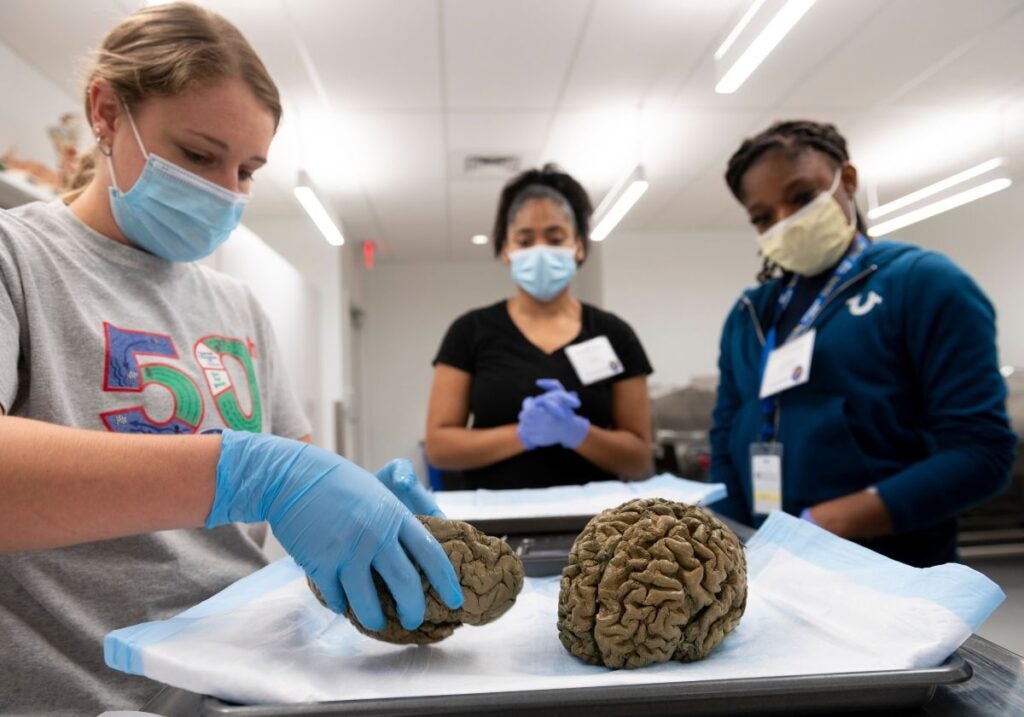Three women standing together wearing masks and gloves looking at samples of the brain while one woman with light hair on the left holds one of the specimens.